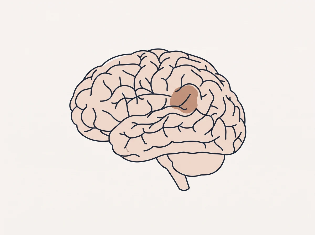 Diagram of the brain showing the region damaged by a stroke